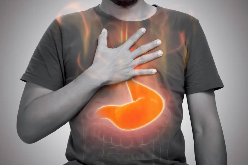 Heartburn
